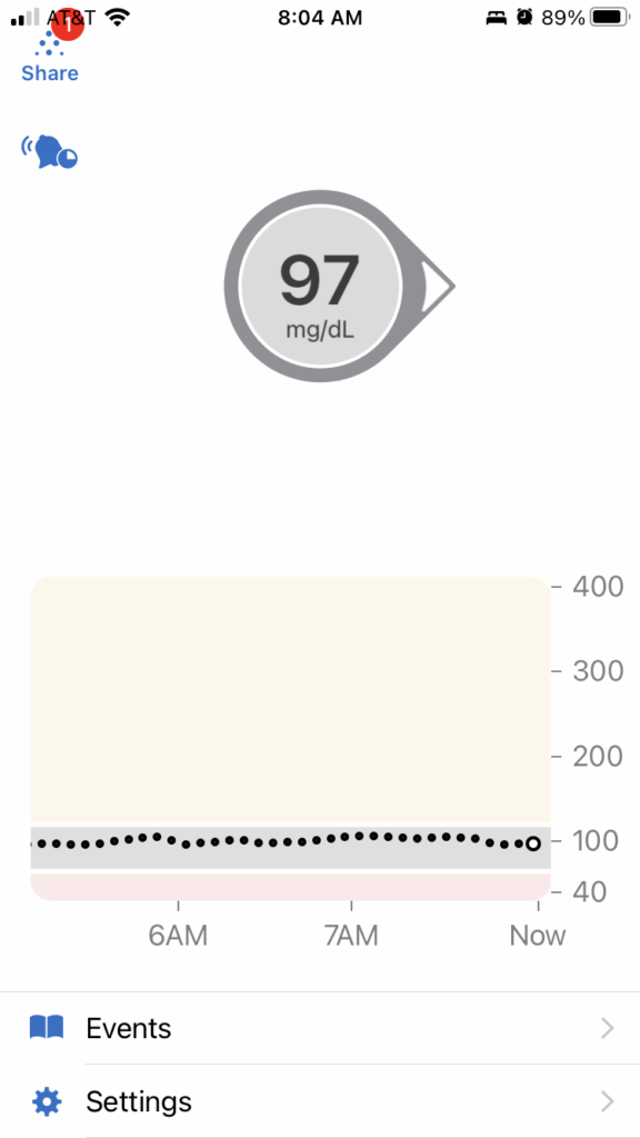 CGM data for low-carb lifestyle for T1D demonstrating balanced blood sugar